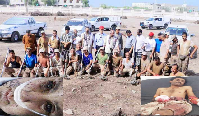 مخلفات العدوان تحصد أرواح المدنيين.. 352 شهيداً وجريحاً معظمهم نساء وأطفال بعدد من المحافظات