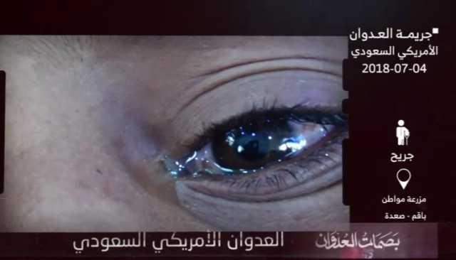 4 يوليو خلال 9 أعوام .. 115 شهيداً وجريحاً وتدمير للمنزل والممتلكات العامة والخاصة في حجة وصعدة وتعز