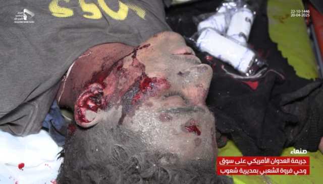 بالصور والفيديو.. شاهد اللحظات الأولى لجريمة استهداف العدوان الأمريكي حي وسوق فروة الشعبي بالعاصمة صنعاء (هذا ما تم استهدافه)