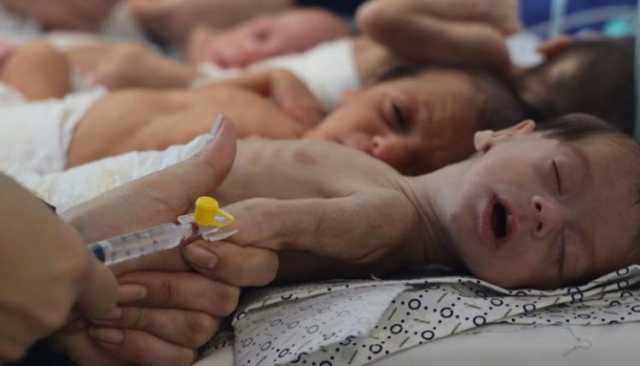 التجويع كسلاح… كيف تحوّلت بطون أطفال غزة إلى ساحة حرب؟