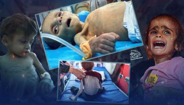 غزة تجوع والمساعدات تتعفن خارج أسوارها، فهل تعفنت الإنسانية أيضاً ؟ّ!
