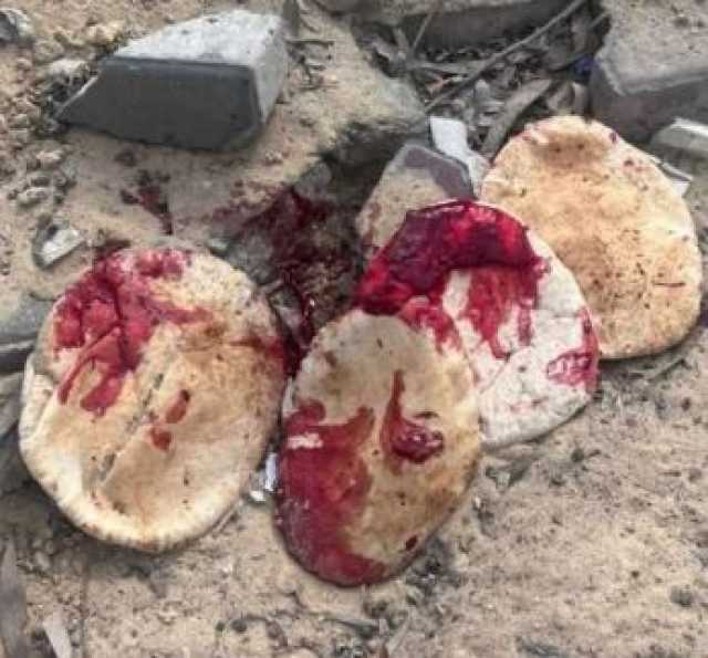 أطفال غزة يموتون جوعًا في حضن العالم الصامت