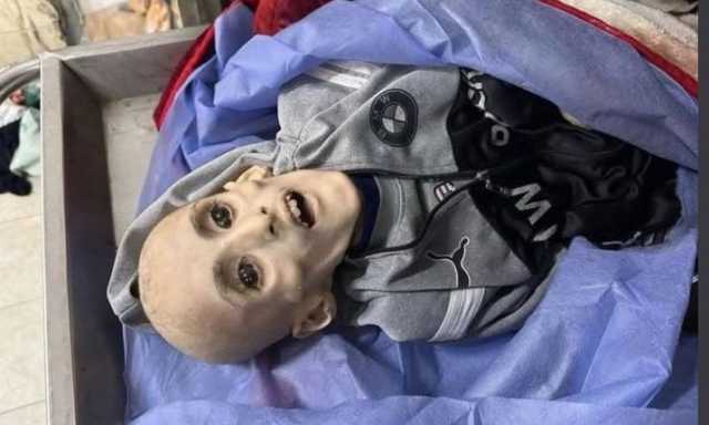خارجية فرنسا: ما يجري في غزة فضيحة إنسانية يجب أن تتوقف فوراً