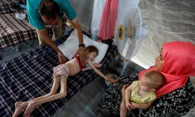 ١١٣ شهيدا من الجوعى في غزة غالبيتهم أطفال