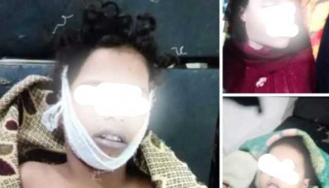 وفاة ثلاث فتيات غرقًا في خزان مياه بتعز