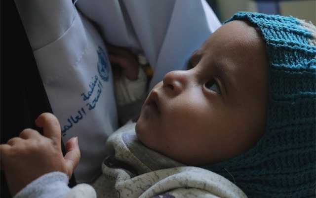 الصحة العالمية: نصف سكان اليمن بحاجة إلى مساعدات صحية