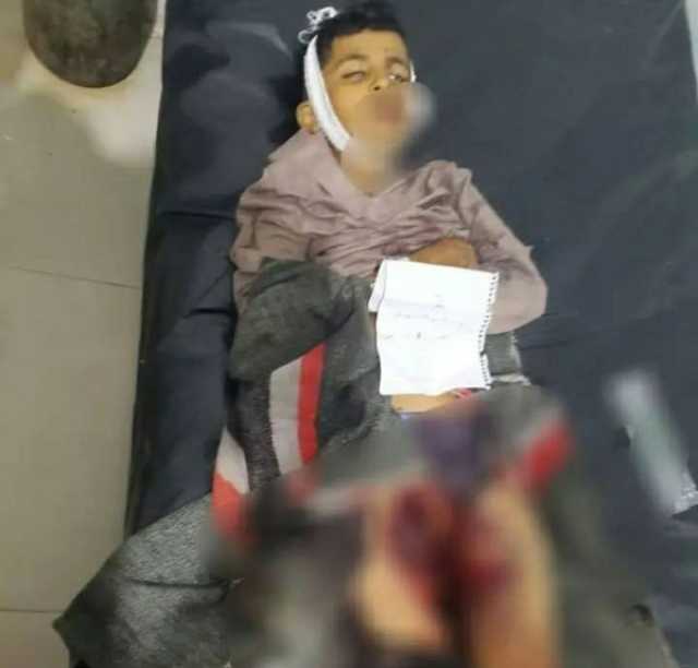 تعز.. مقتل 5 أطفال وسط اتهامات متبادلة بين الحوثيين والقوات الحكومية 