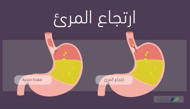 الرعاية: الجهاز الهضمي أكثر عرضة للأمراض في الصيف