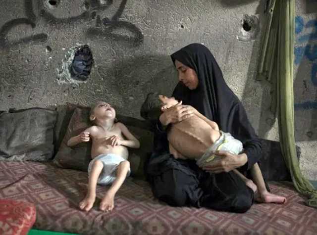 أكدت أن حياة الآلاف في خطر.. الأمم المتحدة: 100 طفل فلسطيني قضوا جوعاً في غزة