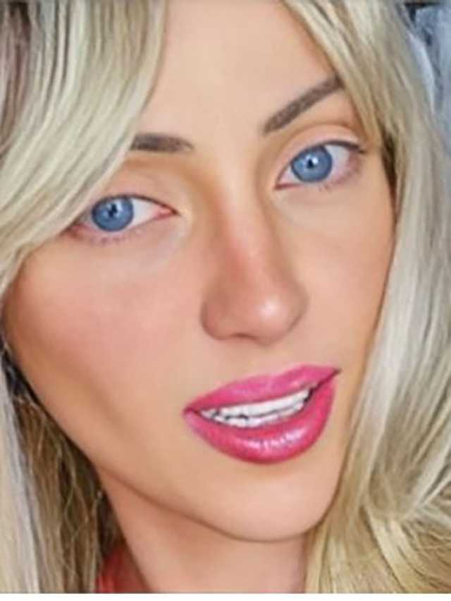 وفاة «باربي البرازيلية» بعد 27 عملية تجميل