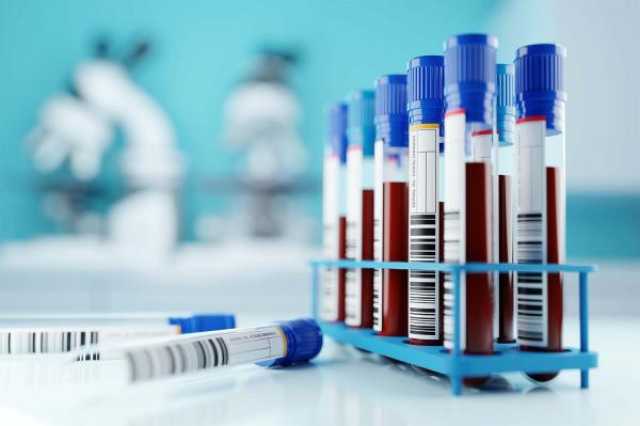 نجاحات مذهلة في تجارب علاج سرطان الدم