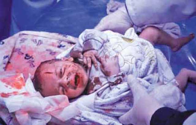 قوات العدو الصهيوني ترتكب 13 مجزرة خلال 24 ساعة ضد المدنيين في غزة