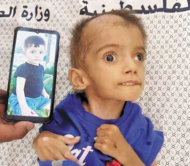 الأغذية الفاسدة تدخل على خط الموت في قطاع غزة