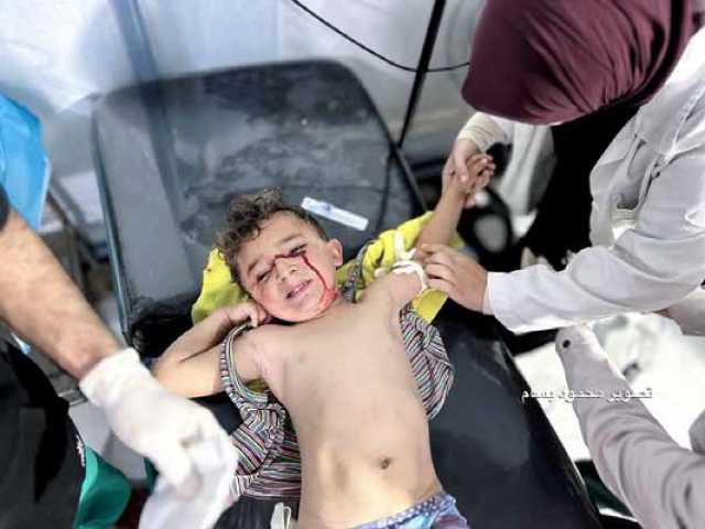 71 شهيدًا و153 مصاباً وصلوا مستشفيات غزة خلال 24 ساعة الماضية ومركز الأطراف يستقبل 600 حالة بتر
