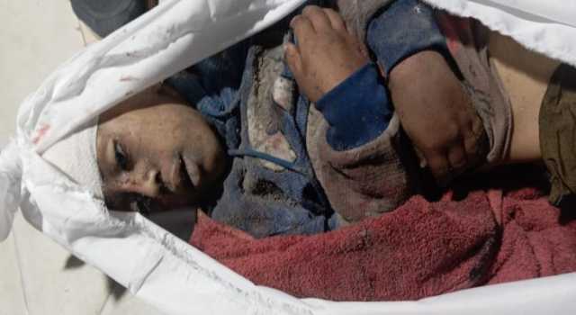 19 شهيدا بينهم 9 اطفال ومصابين في مجزرة صهيونية بقصف عيادة للوكالة في جباليا