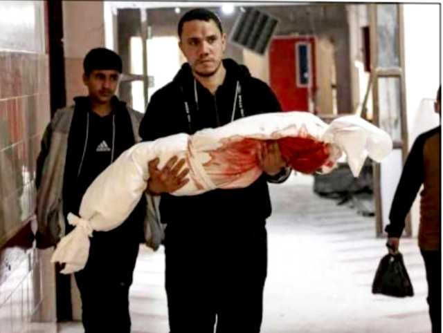 عدد شهداء غزة يتخطى الثمانين خلال 24 ساعة