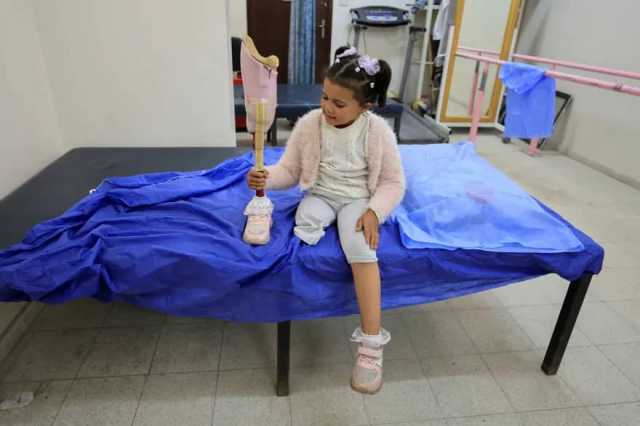 “أوتشا”: 4500 شخص بغزة يحتاجون إلى أطراف اصطناعية