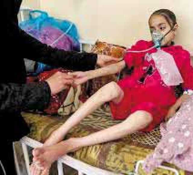 التجويع كسلاح.. أمهات يودعن أطفالهن جوعى في غزة المحاصرة