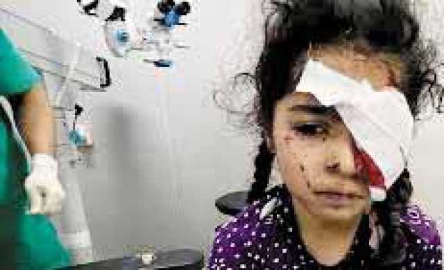 1500غزي فقدوا البصر بسبب الحرب