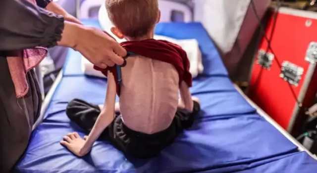 منظمة الصحة العالمية تناشد لإدخال الغذاء والدواء إلى غزة لوقف وفيات المجاعة