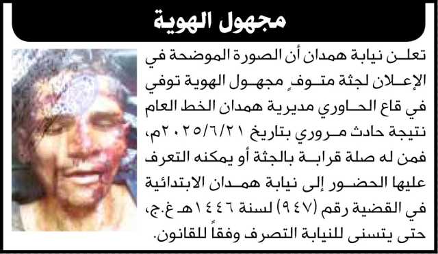 تعلن نيابة همدان أن الصورة الموضحة في الإعلان لجثة متوف مجهول الهوية
