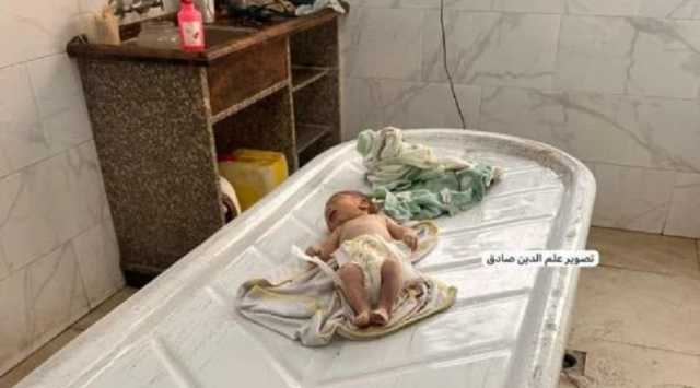 استشهاد رضيع فلسطيني بسبب المجاعة في غزة