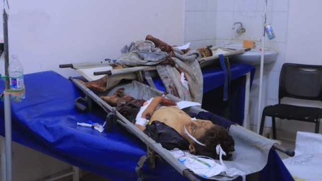 استشهاد 5 أطفال بقصف مدفعي لمرتزقة حزب الإصلاح في الهشمة بتعز