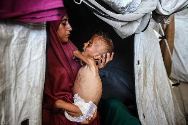 صحيفة بريطانية: العالم خذل الفلسطينيين وتجويع غزة وصمة عار