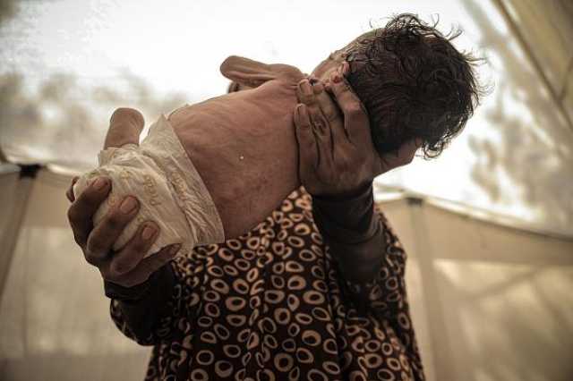“أونروا”: هناك مجاعة حقيقية في غزة