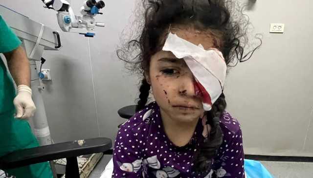 1500 فلسطيني فقدوا أبصارهم جراء حرب الإبادة في غزة