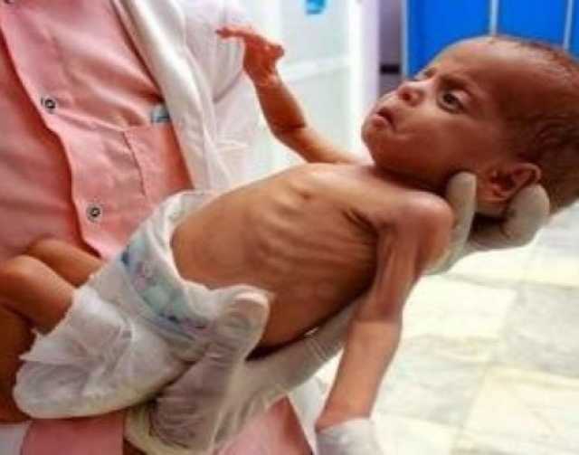الإعلامي الحكومي:100,000 طفل في غزة يوجهون خطر الموت الجماعي