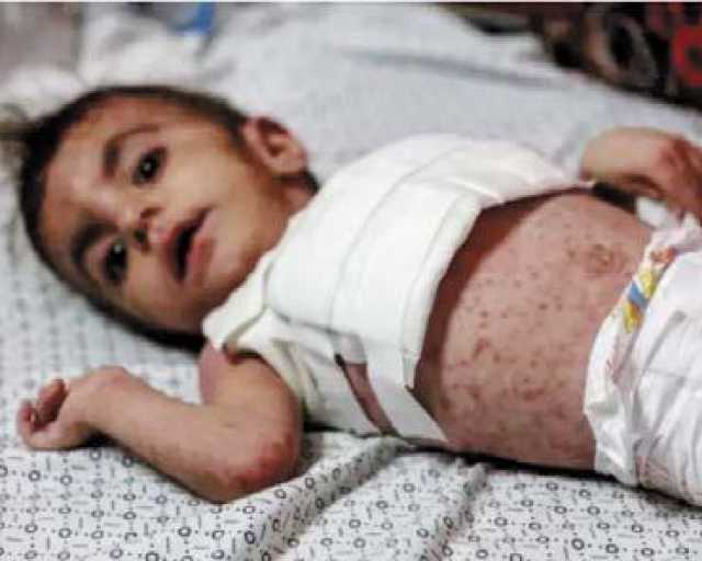«يونيسف» تكشف عن أرقام مرعبة لتداعيات العدوان الإسرائيلي على أطفال غزة