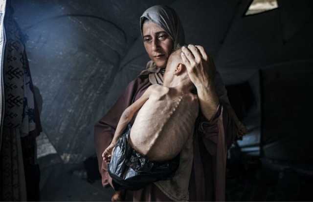 أوكسفام: الأمراض بغزة قد تتحول إلى كارثة قاتلة