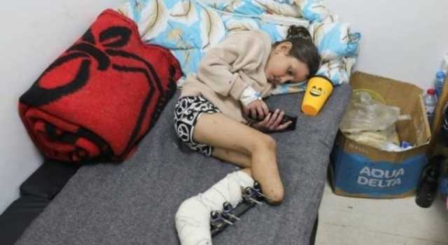 أكثر من 6500 حالة بتر في غزة منذ بدء جريمة الإبادة