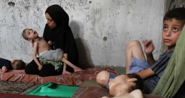 “يونيسيف”: إصابة 5 آلاف طفل بسوء التغذية في غزة خلال نصف شهر