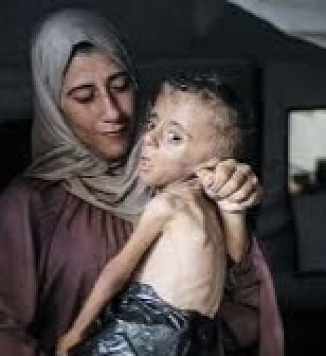 الصحة بغزة”:تسجيل خمس حالات وفاة جديدة نتيجة المجاعة خلال الـ24 ساعة الماضية