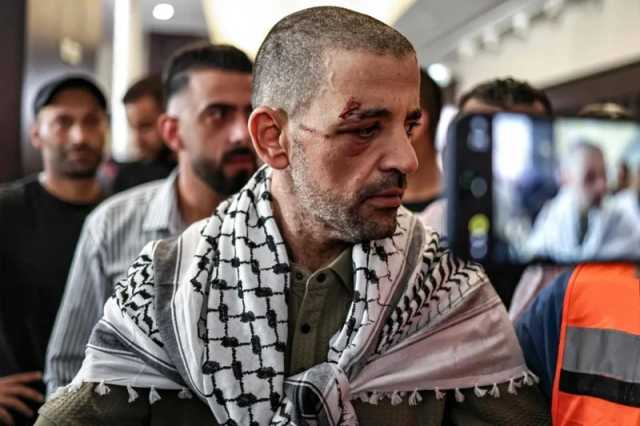 “مؤسسة الحق” تحث الأسرى المحررين على توثيق انتهاكات العدو بحقهم تمهيداً لملاحقتهم قضائياً