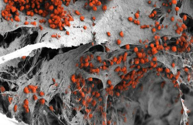 إنجاز علمي.. ابتكار أول نموذج مختبري لنخاع العظم البشري