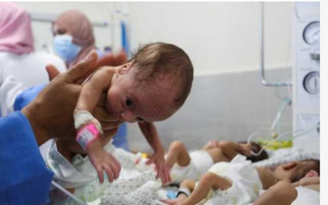 “الصحة بغزة”: ارتفاع حاد بفقر الدم بين الأطفال ما يخلق “جيل مُشوَّه صحيًا”