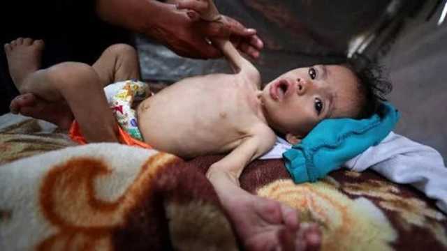 غزة للسرطان: فرص نجاة المرضى تتلاشى بسرعة نتيجة الدمار ومنع السفر ونقص الأدوية