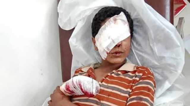 مركز التعامل مع الألغام: 10,689 شهيداً وجريحاً بمخلفات الحرب والقنابل العنقودية حتى ديسمبر 2023