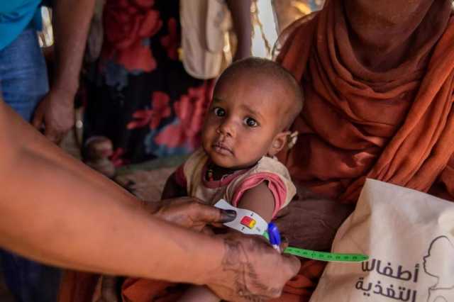 ممثل يونيسيف في السودان: شاهدت أكبر أزمة إنسانية فى العالم على الأطفال والأسر