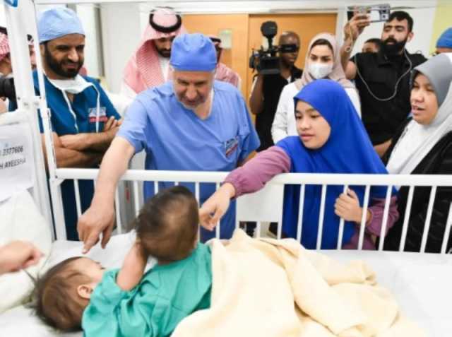 إنفاذًا لتوجيهات القيادة.. بدء فصل التوأمين السياميين الفلبينيين 'أكيزا وعائشة'