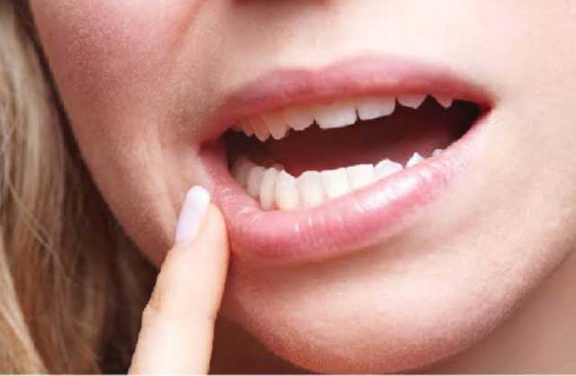 بحضور خبراء عالميين.. انطلاق المؤتمر الدولي الثاني عشر لعلاج جذور الأسنان بجدة