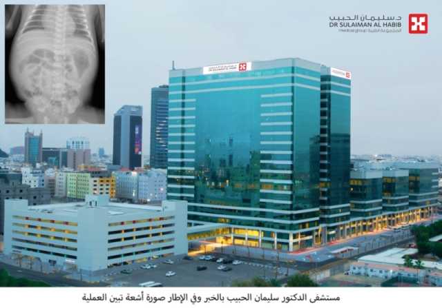 مستشفى الدكتور سليمان الحبيب بالخبر ينقذ طفلاً عمره '15' دقيقة من عيب خلقي نادر