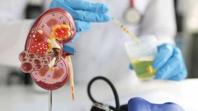 الذكاء الاصطناعي والخلايا الجذعية مستقبل واعد لعلاج قصور الكلى