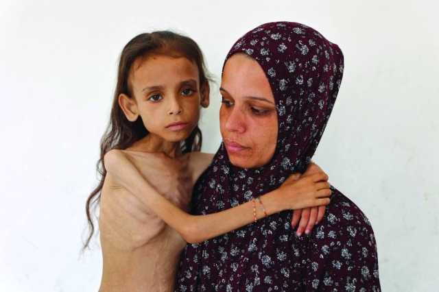 اليونيسيف: أطفال غزة يموتون بمعدل غير مسبوق وسط المجاعة