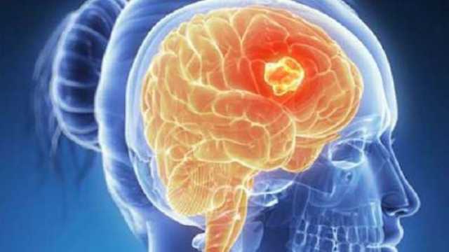 3 أطعمة احرص على تناولها تقلل من الإصابة بالسرطان.. ادمجها في نظامك الغذائي