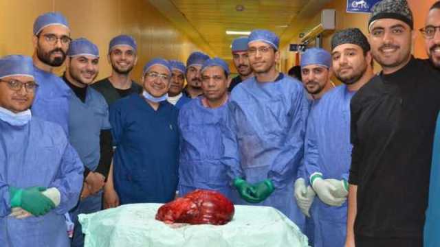 جامعة أسيوط: فريق طبي ينجح في استئصال ورم ضخم من سيدة تبلغ 40 عاما