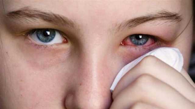 تحذيرات من مرض «نزيف العين» المرعب بعد اكتشاف حالات في أفريقيا